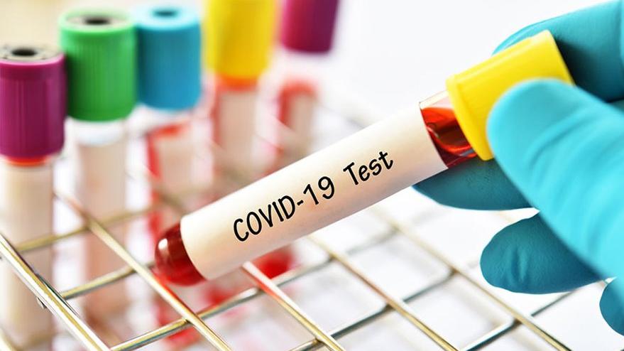 Kovancılar’da Koronavirüse Karşı Bağışıklık Oranının Tespiti Amaçlı Antikor Testi Çalışmalarımız Devam Ediyor